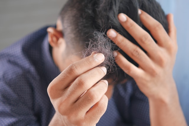 Causa e sintomas para Alopecia Areata 9 início natural para o tratamento em uma queda lateral